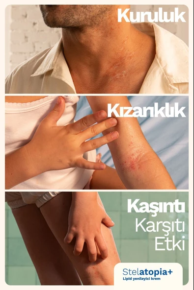 Mustela Stelatopia Cilt Bariyeri Yenileyici - Rahatlatıcı Krem 300ml 2 Adet - Resim 4