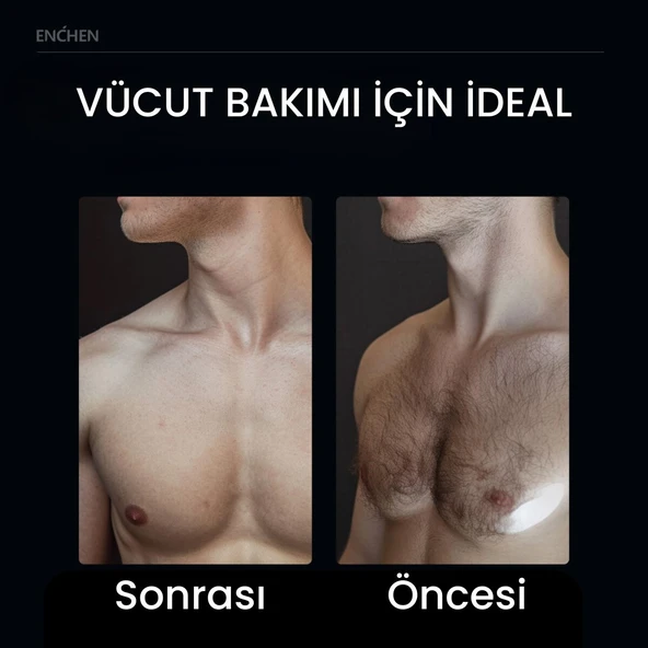 ENCHEN Spark 2 Led Işıklı Tıraş Makinesi - Resim 4