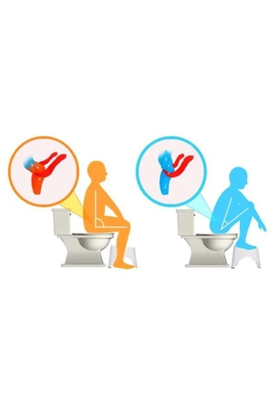 Decobella Klozet Taburesi Klozet Basamak Klozet Ayaklığı - Kırmızı - Resim 4