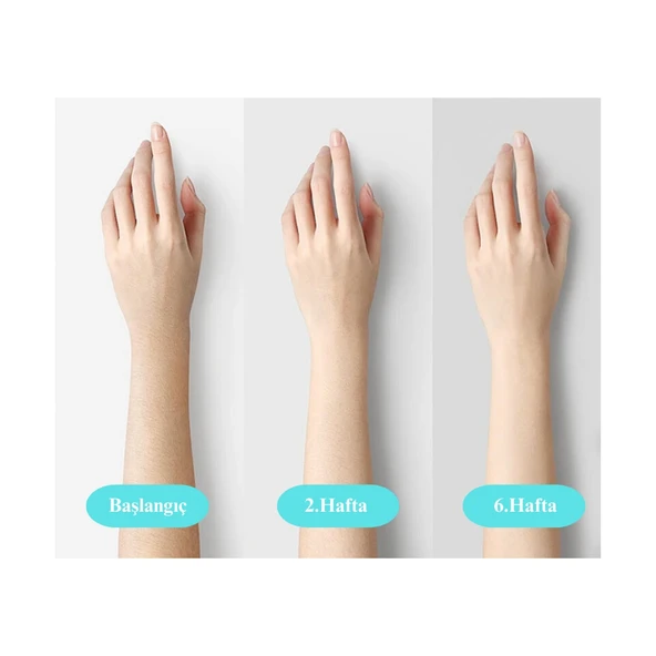 Yui IPLV16 Pro Buz Başlıklı Lazer Epilasyon Aleti - Resim 2