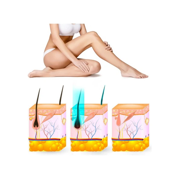 Yui IPLV16 Pro Buz Başlıklı Lazer Epilasyon Aleti - Resim 3