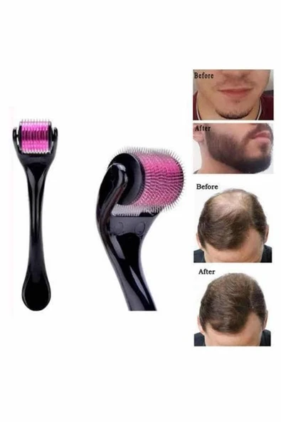 Saç Çıkarma Tarağı Dermaroller 540 Iğneli Roller 1 Mm Iğne Cilt Yüz Yenileme Bakım Seti - Resim 3