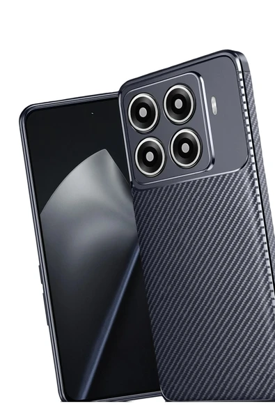 Xiaomi Mi 15T Pro Auto Focus Karbon Kapak - Lacivert-(5796) - Resim 3