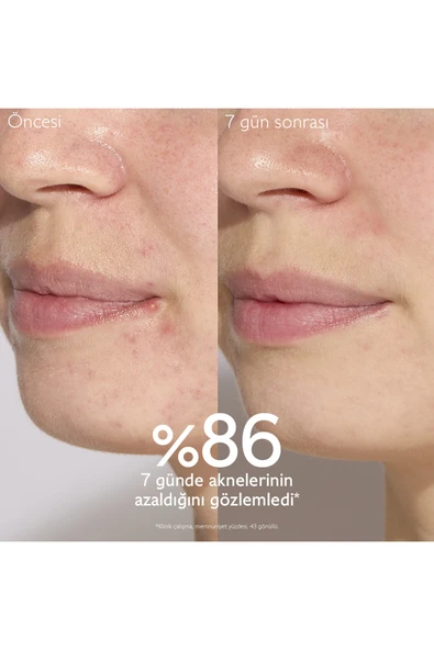 Caudalie Vinopure Akne Karşıtı Salisilik Serum 30 ml - Resim 6