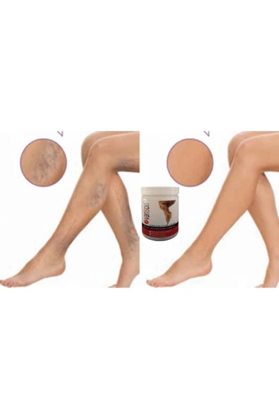 Sepettenevar Varison Va.ris Selü.lit Bacak Bakım Kremi 200 ml X 2adet - Resim 2