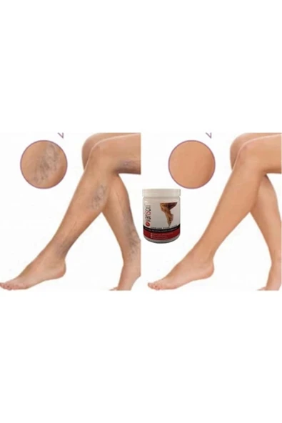 bzrv Varison Varicose Vein Defense Cream Diz Bacak Bakım Kremi 200ml+50ml Ayak - Resim 3