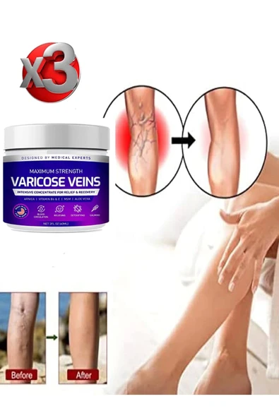 MURAHZE Süper Maximum Strength Varicose Veins Bakım Kremi 100 ml x 3 adet ürün görseli 1