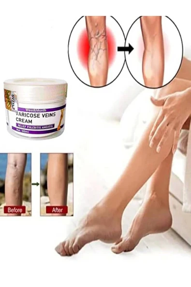 STİL KÖŞESİ Süper West & Month Varicose Vein Va.ris Karşıtı Kremi100 ml 2 Adet - Resim 2