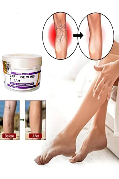 STİL KÖŞESİ Varix Varicose Veins Purple Bakım Kremi 100 ml ürün görseli 1