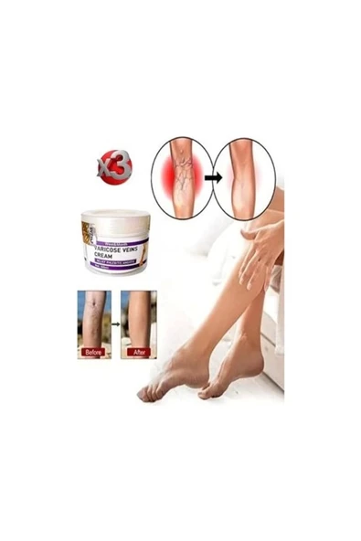 Bravilor Varicose And Spider Veins Soothing Leg Cream Bacak Bakım Kremi 100 ml x 3 Adet ürün görseli 1