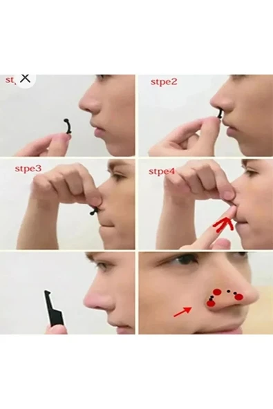 Fontenay Burun Kaldırma Aparatı Pratik Yukarı Kaldırıcı Şekillendirici Düzeltici Burun Düzleştirme - Resim 2