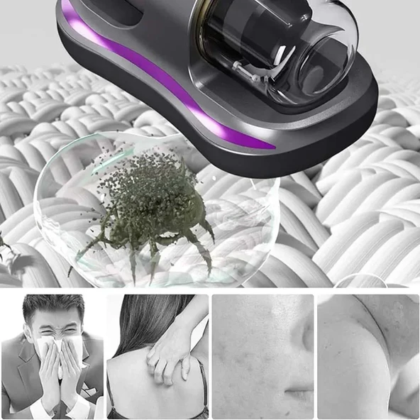 Acarid Temizleme Makinesi El Süpürgesi Yatak Temizleme Mite Temizleme Makinesi Cihazı UV-C Işınlı Temizlik Makinesi Şarjlı Süpürge (5314) - Resim 2