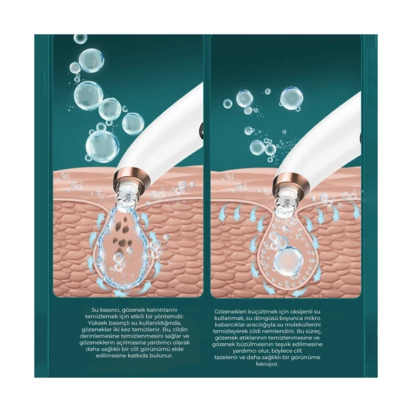 NEUTRON NTL-BR-06H SU HAZNELİ VAKUMLU YÜZ SİYAH NOKTA TEMİZLEYİCİ - Resim 3