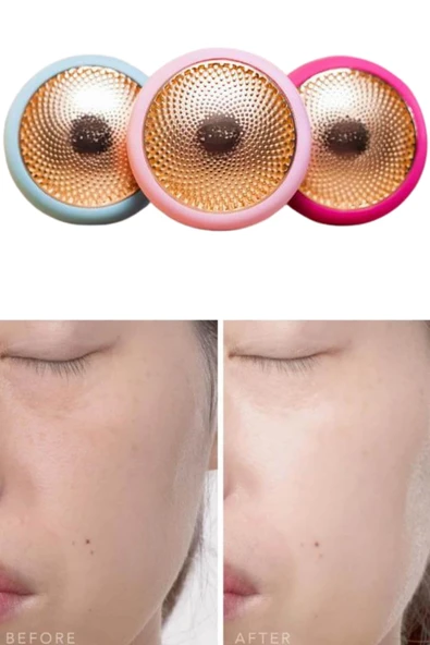 Mini Saç Derisi Masaj Aleti Led Işık Terapisi Cildi Yatıştırır ve Dengeler - Resim 5