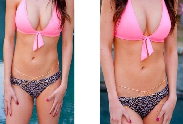 Adonide Bel Zinciri ürün görseli 1