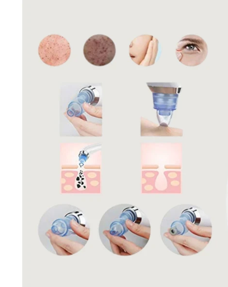 Alova Siyah Nokta Temizleme Vakum Cihazı - Resim 2