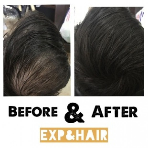 EXP&HAIR PREMIUM SAÇ DOLGUNLAŞTIRICI TOZ - 7