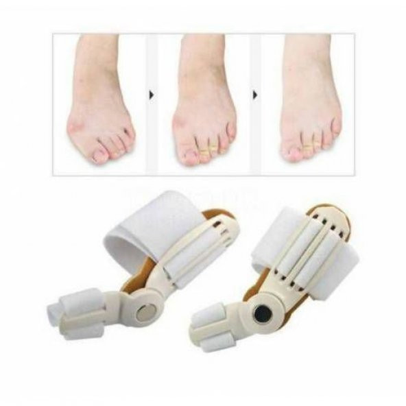 Ayak Baş Parmak Kemik Düzeltici 1.KALİTE Halluks Valgus Makaralı Kemik Düzeltici 1 Adet Gece Ateli - 3