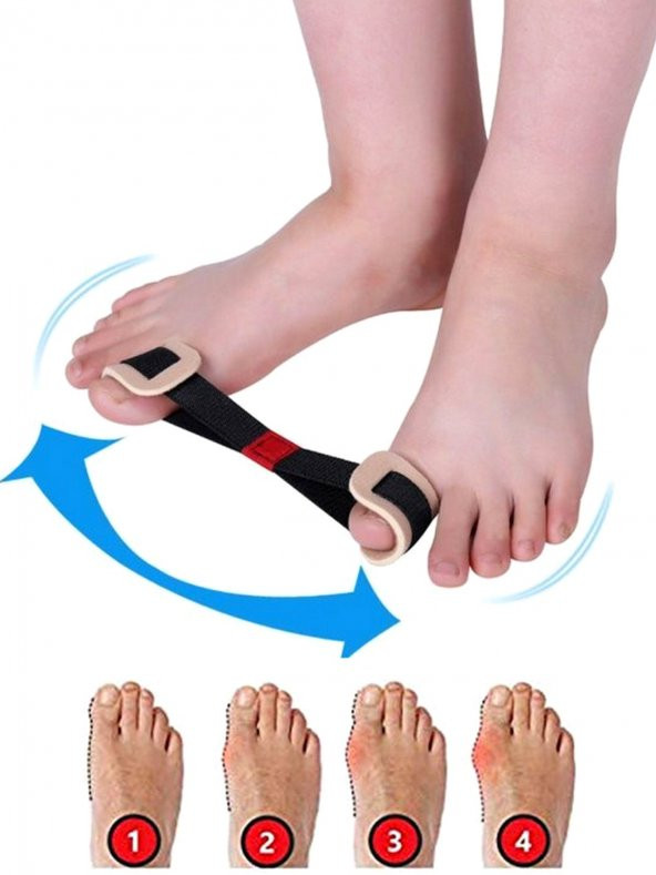 Baş Parmak Kemik Düzeltici Egzersiz Lastiği Baş Parmak Kemik Koruyucu Ayak Bunyon Egzersiz Aleti ürün görseli 1