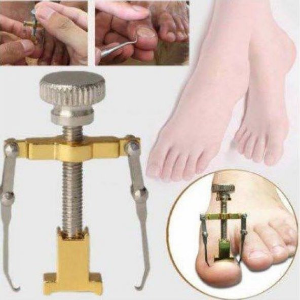 Orijinal Çelik Batık Tırnak Aparatı Batık Tırnak Düzeltme Aleti Batan Tırnak Çıkartıcı Ayak Tırnak B