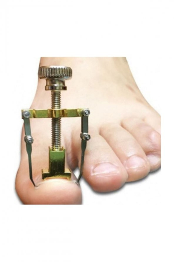 Orijinal Çelik Batık Tırnak Aparatı Batık Tırnak Düzeltme Aleti Batan Tırnak Çıkartıcı Ayak Tırnak B - 2