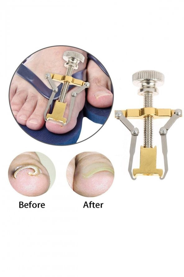 Batık Tırnak Çıkarıcı Aparat 12 Parça Manikür Seti Çantalı - 4