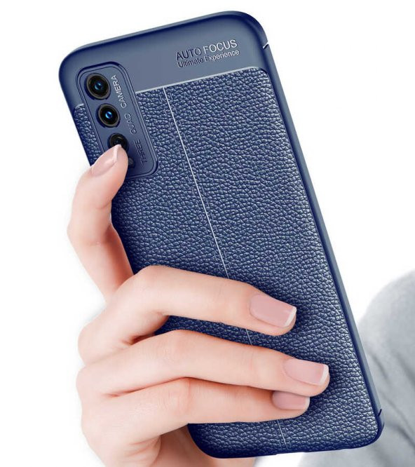 Vivo Y20 Kılıf Zore Niss Deri Desenli Silikon Kılıf - 5