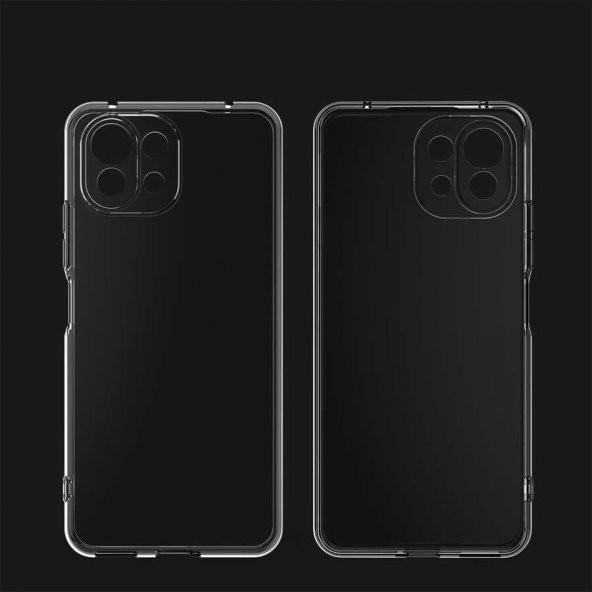 Xiaomi Mi 11 Kılıf Kamera Korumalı Süper Silikon Kapak - 3