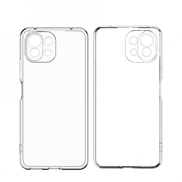 Xiaomi Mi 11 Kılıf Kamera Korumalı Süper Silikon Kapak - 5