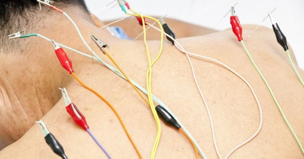 Maxi Elektro Akupunktur Cihazı - 3