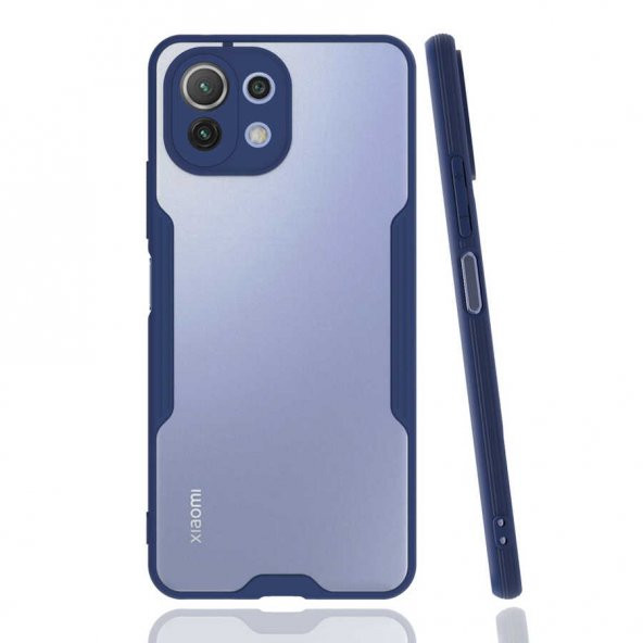 Xiaomi Mi 11 Lite Kılıf Kamera Korumalı Arkası Şeffaf Silikon - 6