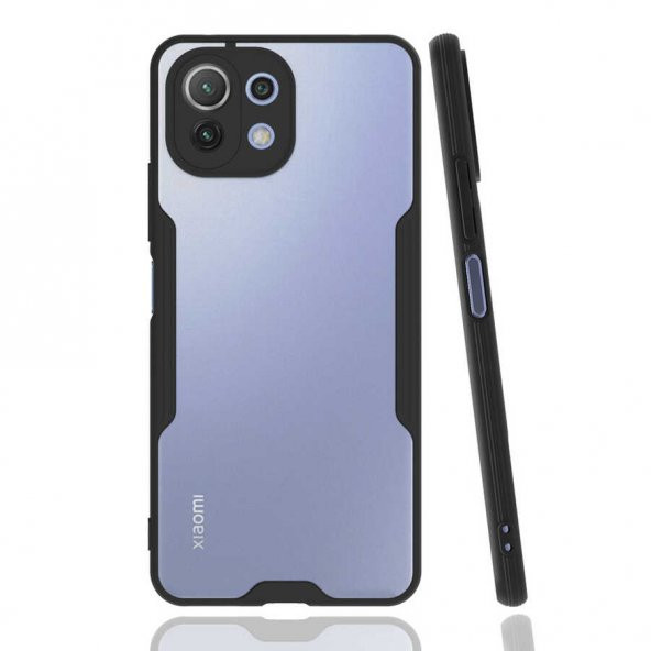 Xiaomi Mi 11 Lite Kılıf Kamera Korumalı Arkası Şeffaf Silikon - 8