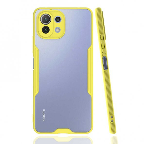 Xiaomi Mi 11 Lite Kılıf Kamera Korumalı Arkası Şeffaf Silikon - 9