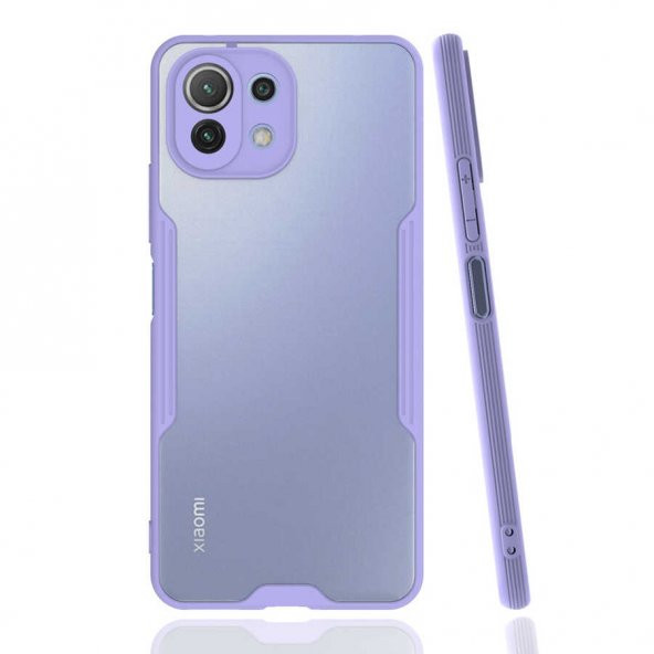 Xiaomi Mi 11 Lite Kılıf Kamera Korumalı Arkası Şeffaf Silikon - 11