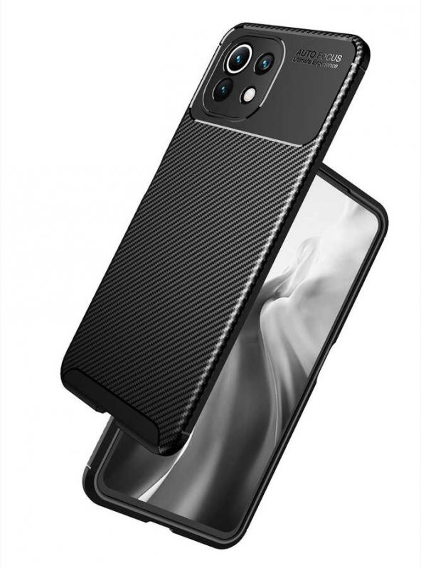 Xiaomi Mi 11 Lite Kılıf Antişok Carbon Desenli Regnor Silikon Kapak - 2