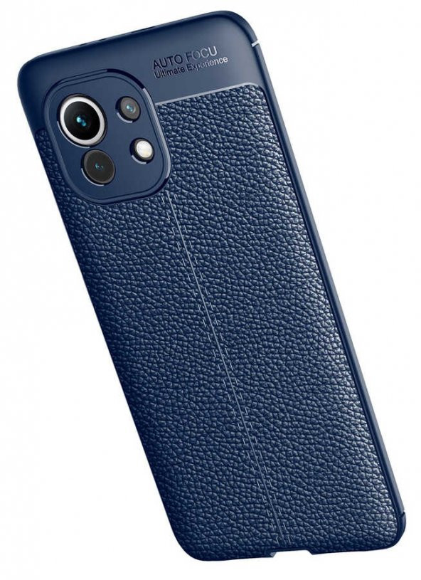 Xiaomi Mi 11 Kılıf Niss Antişok Korumalı Deri Silikon Kapak - 3