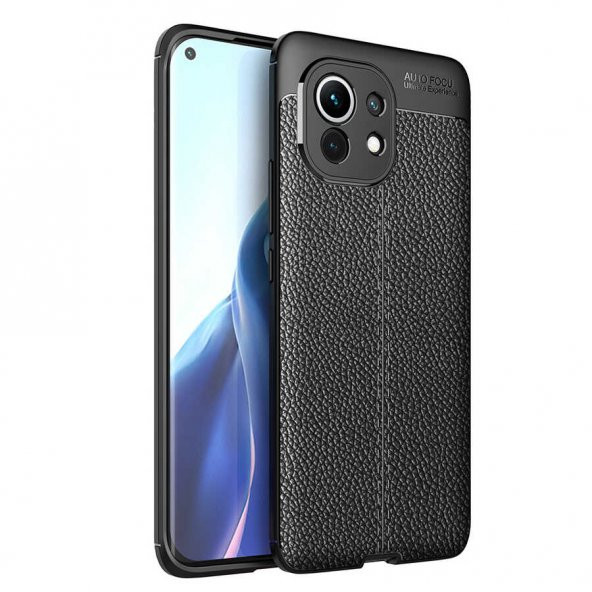 Xiaomi Mi 11 Kılıf Niss Antişok Korumalı Deri Silikon Kapak - 10