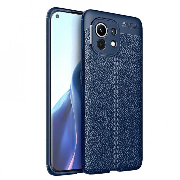 Xiaomi Mi 11 Kılıf Niss Antişok Korumalı Deri Silikon Kapak - 11