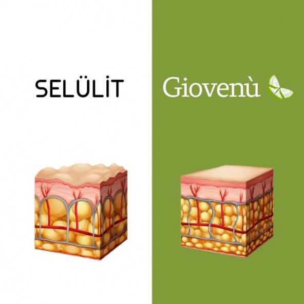 Giovenu Selülit Karşıtı Vücut Kremi - 3