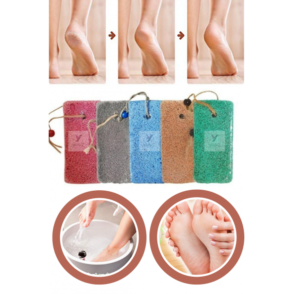 Yayke Lazer Topuk Taşı Ponza Taşı Kadife Yumuşaklığı Nasır Peeling (3 Adet)