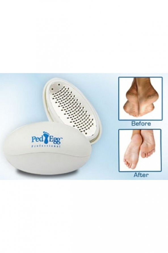 Ped Egg Topuk Törpüsü Kutulu