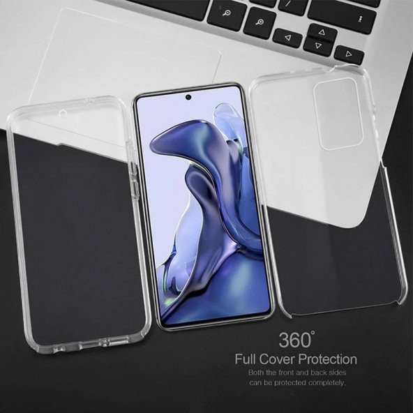 Xiaomi Redmi Note 11 360 Derece Şeffaf Silikon Kılıf Komple Koruma - 3