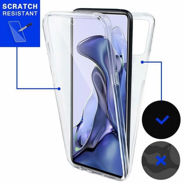Xiaomi Redmi Note 11 360 Derece Şeffaf Silikon Kılıf Komple Koruma - 6