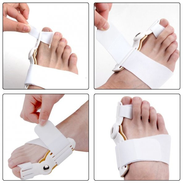 Ayak Baş Parmak Kemik Koruyucu Bunyon Kemik Çıkıntı Düzeltici Makaralı Gece Ateli Halluks Valgus - 2