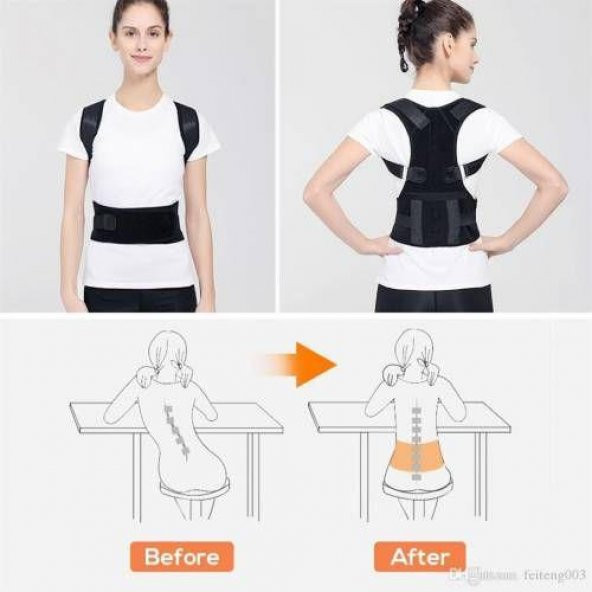 Dik Duruş Bel Sırt Ağrısı Destek Kamburluk Önlemek Için Omurga Postur Düzeltici Aparat - Resim 6