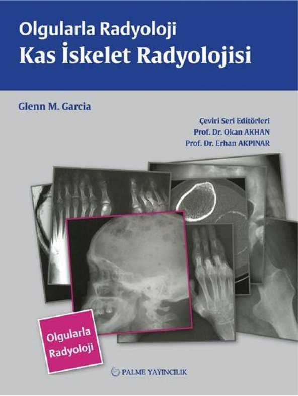 OLGULARLA RADYOLOJİ KAS İSKELET RADYOLOJİ (PALME)