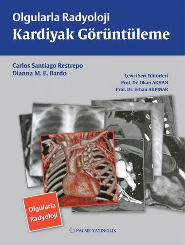 OLGULARLA RADYOLOJİ KARDİYAK GÖRÜNTÜLEME (PALME)