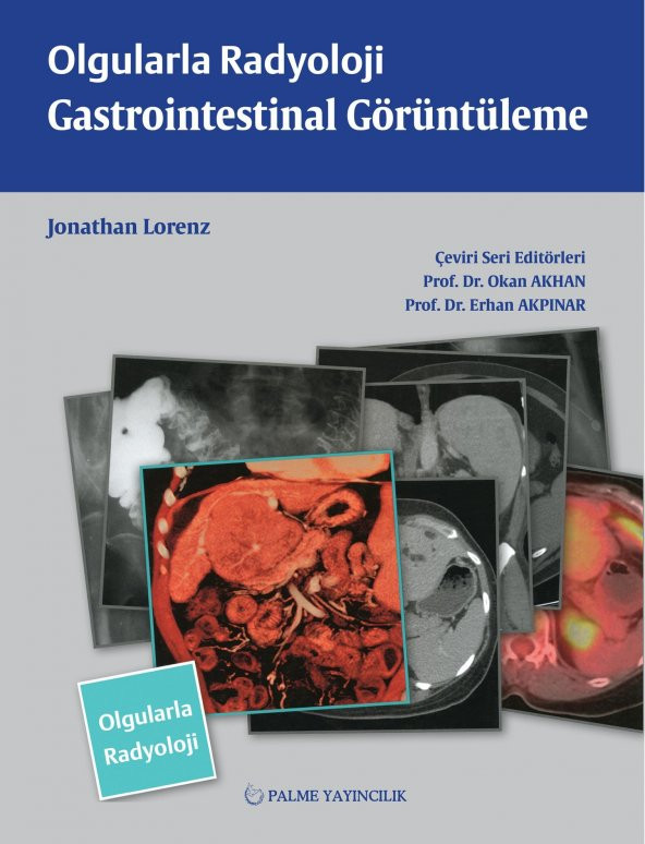 OLGULARLA RADYOLOJİ GASTROİN.GÖRÜNTÜLEME (PALME) - Resim 2