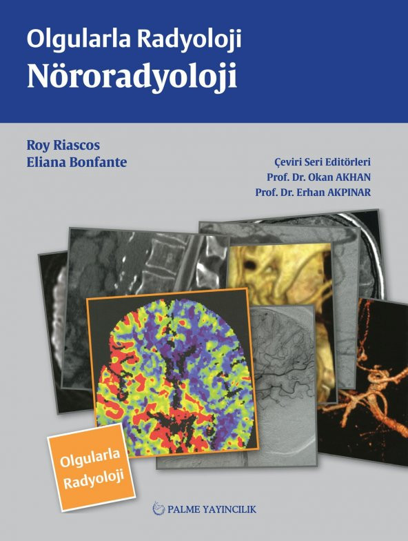 OLGULARLA RADYOLOJİ NÖRORADYOLOJİ (PALME) - 2