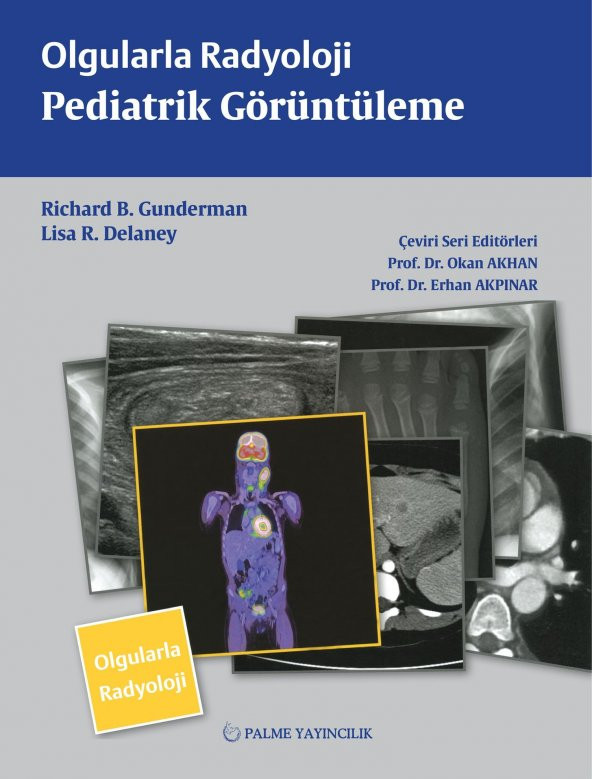 OLGULARLA RADYOLOJİ PEDİATRİK GÖRÜNTÜLEME (PALME) - 2